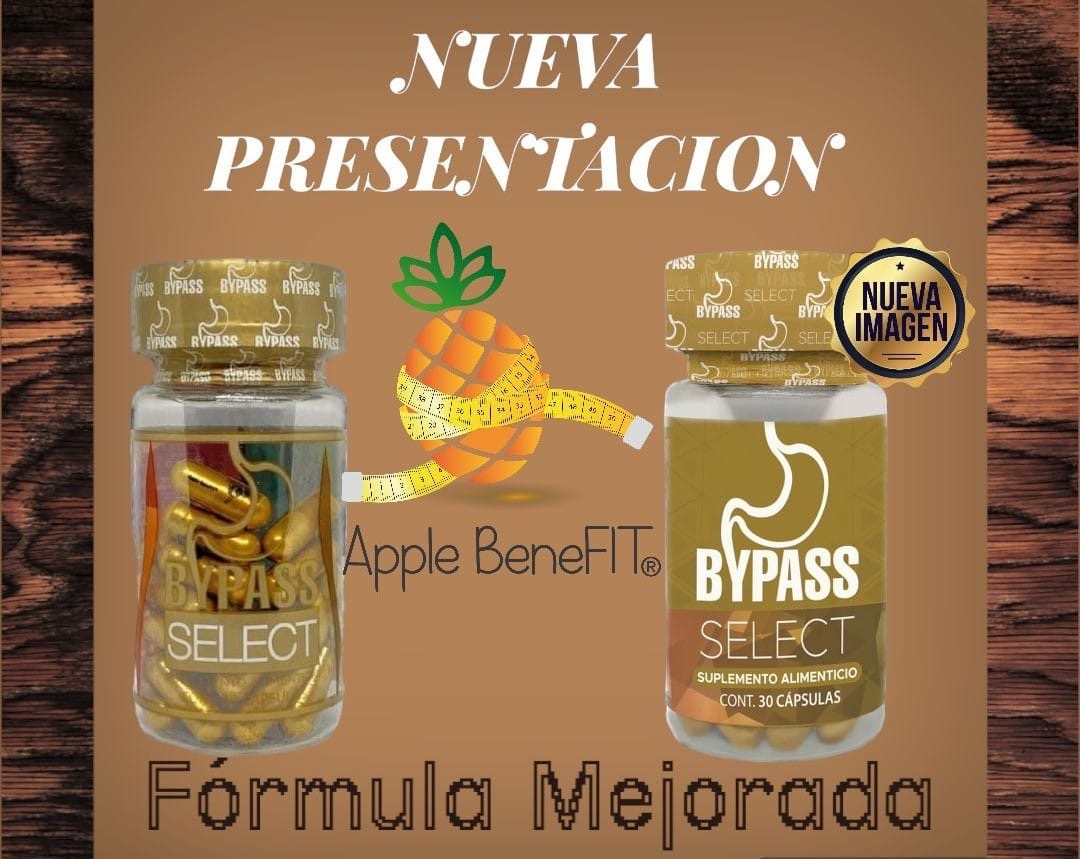 Bypass Select